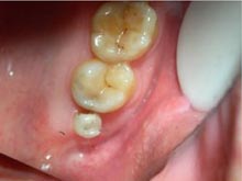 牙齿结构异常
