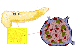 胰岛细胞破坏 