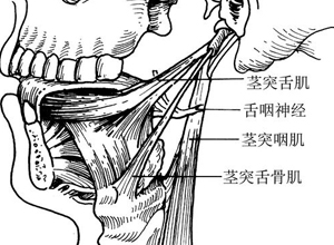 咽部肌肉运动障碍