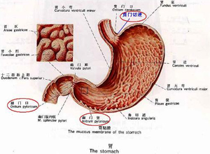 胃体胃窦图片